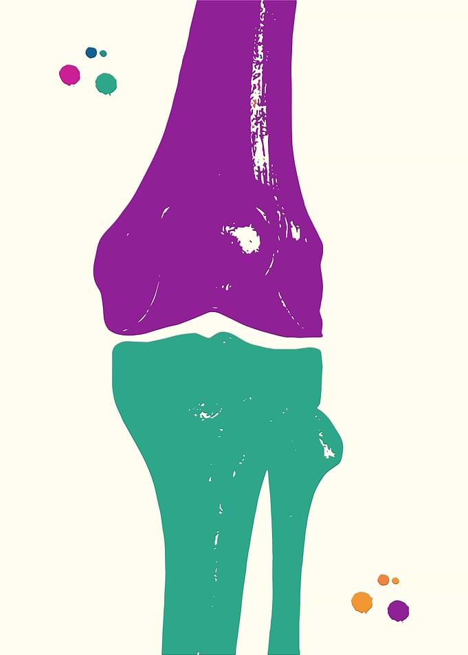 Medical Painting Knee Bone
