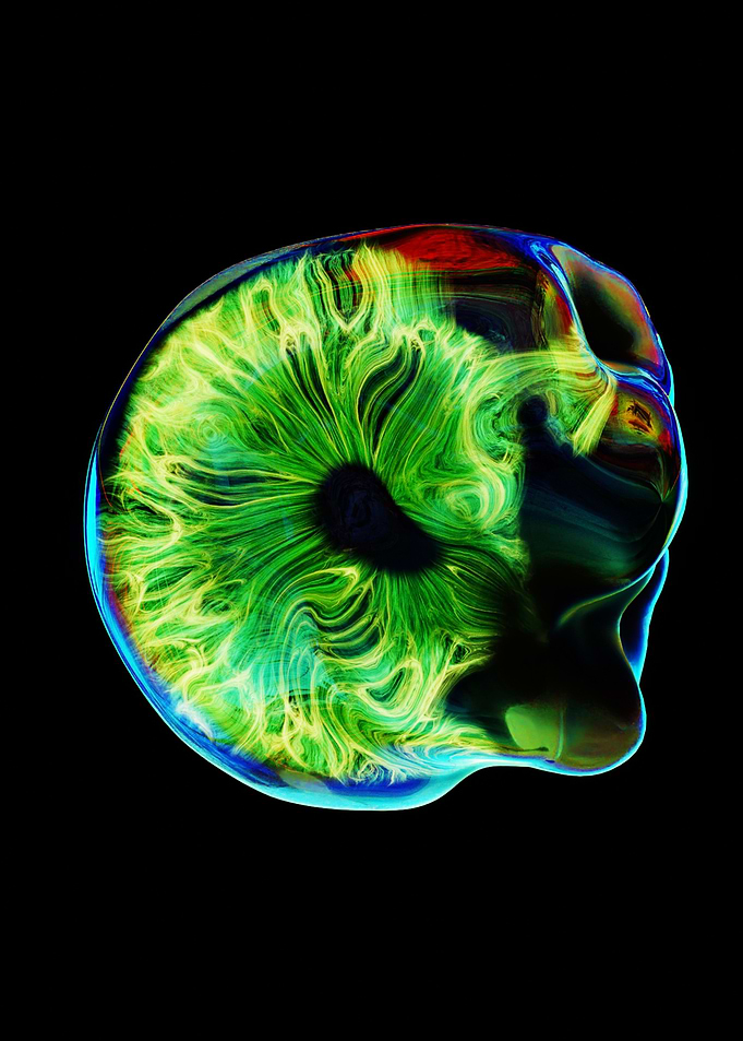 EYE 03