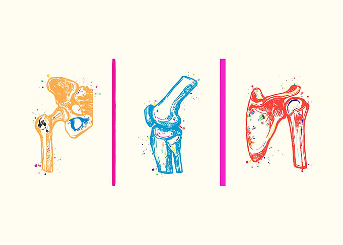 Orthopedic Art