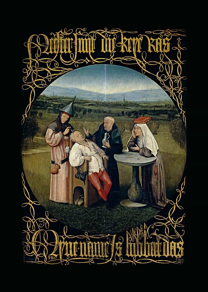 Extraction of the Stone