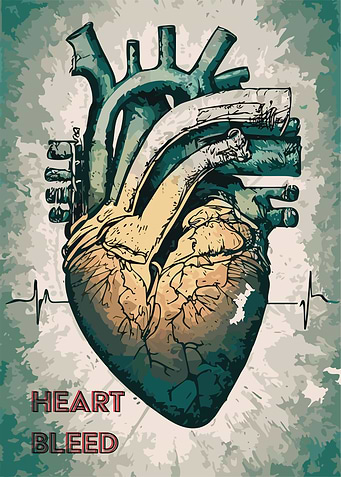 Heart Bleed
