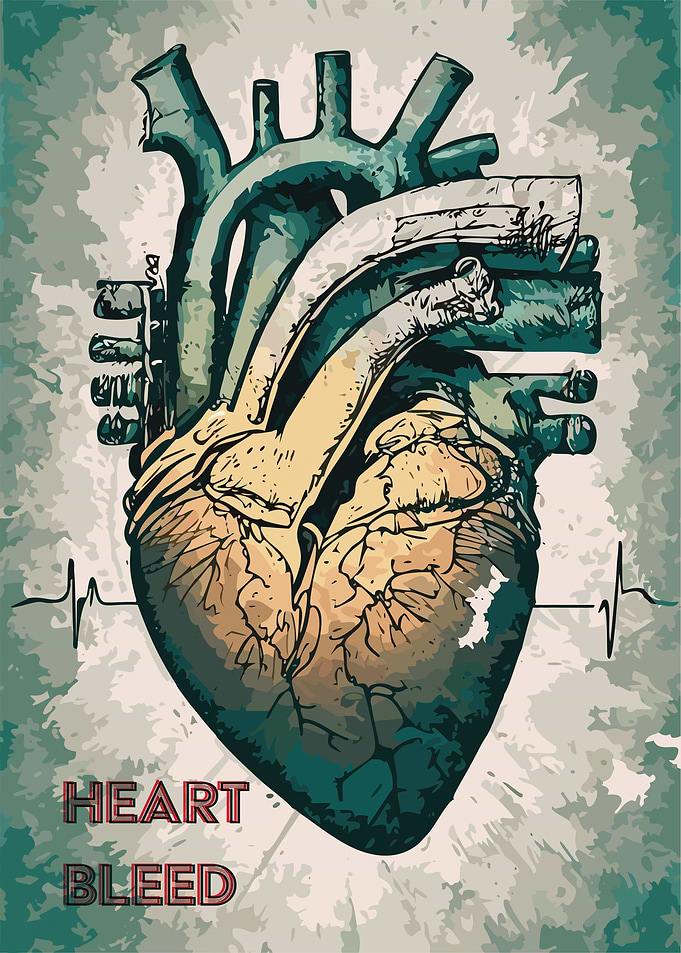 Heart Bleed