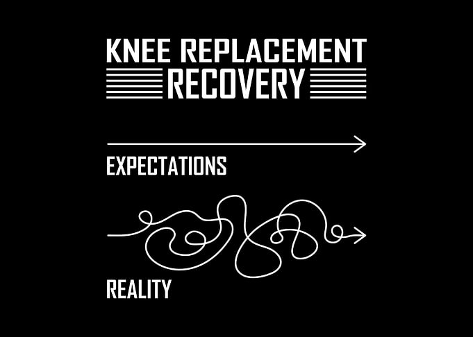Knee Surgery