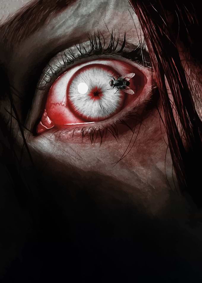 Fly in Eye
