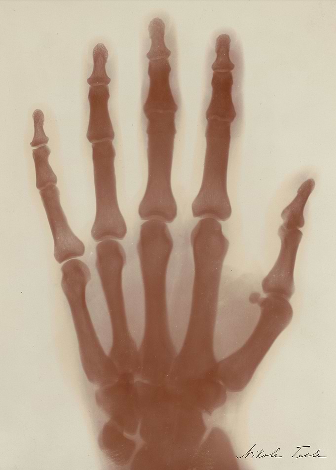 Nikola Tesla's Hand X-ray