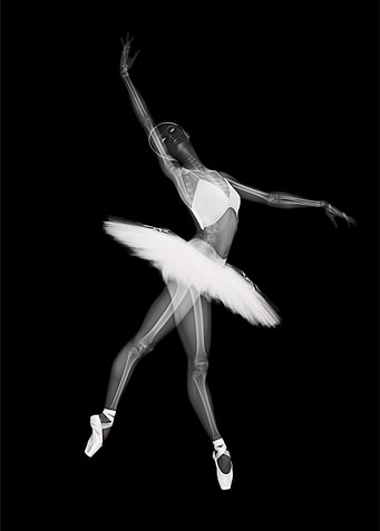 X-Ray Ballet Dancer