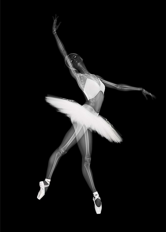 X-Ray Ballet Dancer