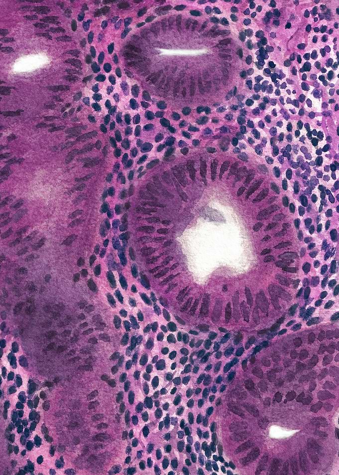 Uterus