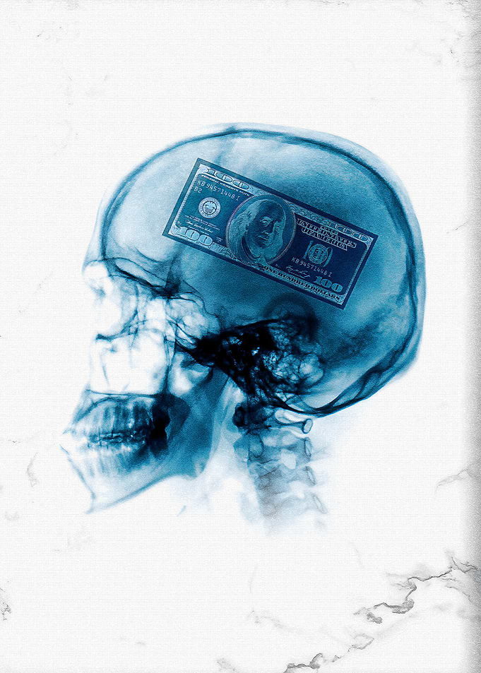 Cash Conscious – X-Ray Skull with $100 Brain Implant