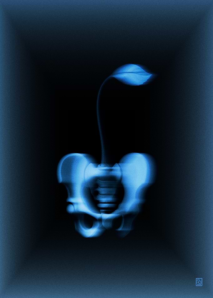 CERASUS PELVIS