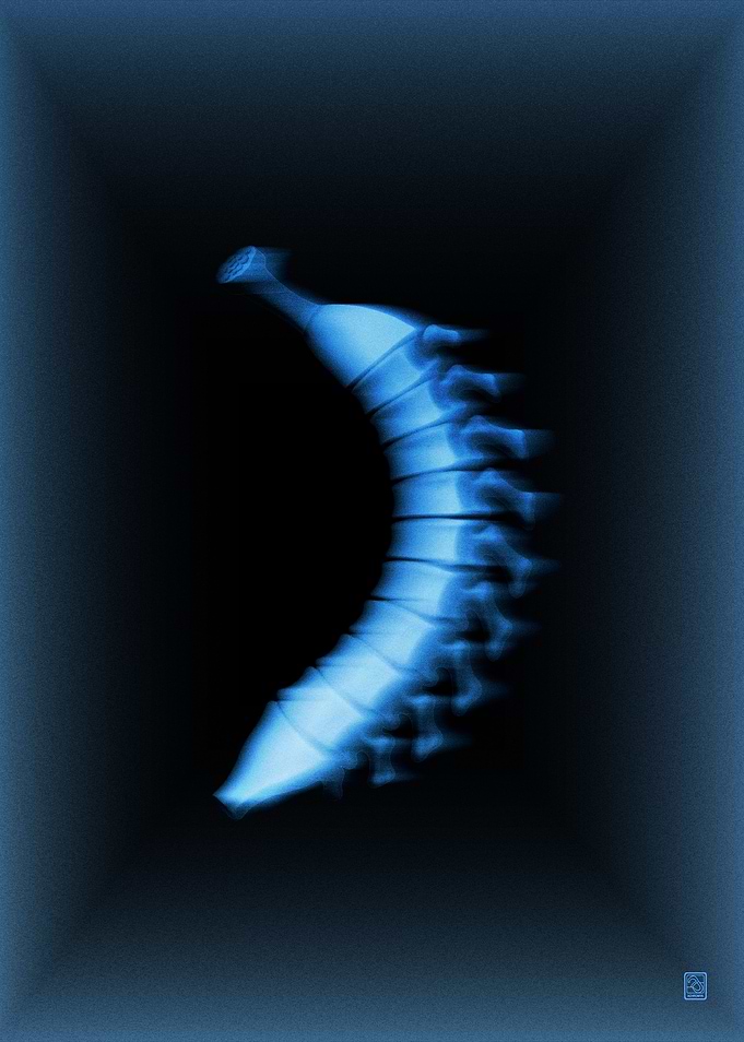 MUSA VERTEBRAE