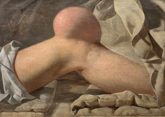 Leg with Tumor Painting