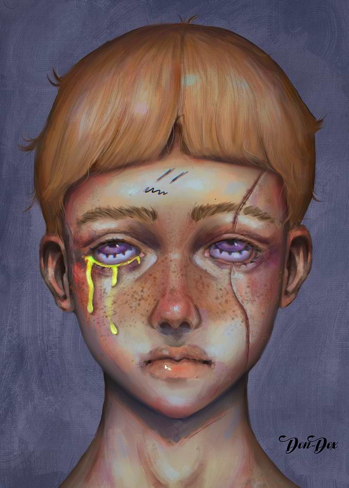 Wounded Boy Portrait