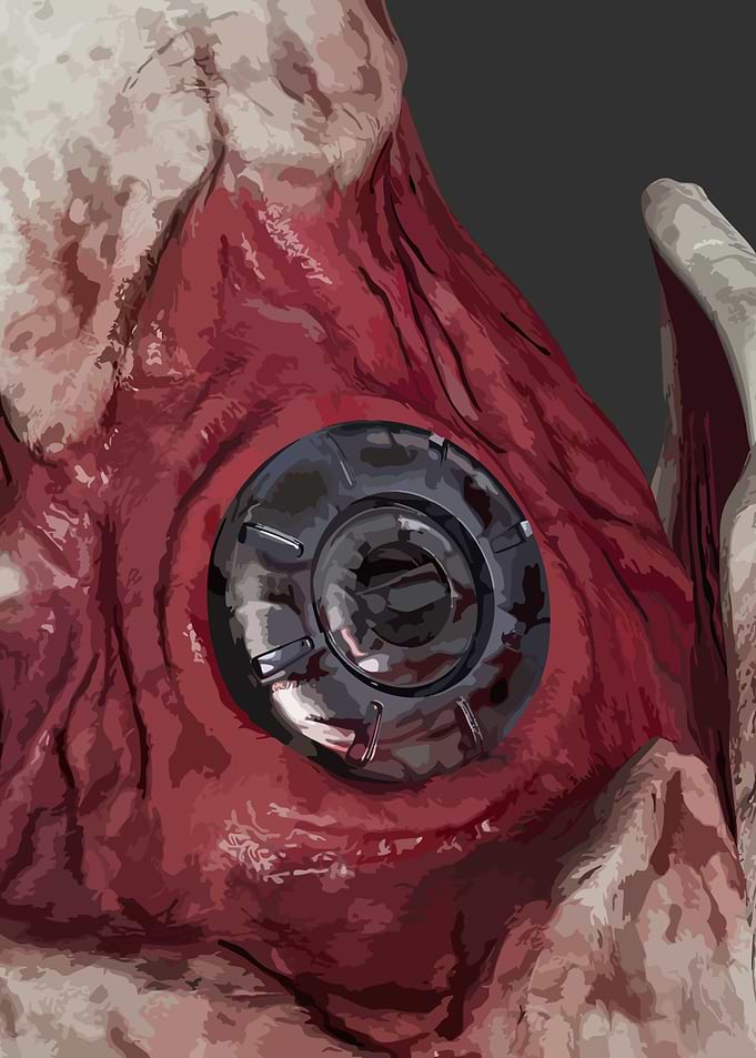 Cybernetic Implant in Organic Tissue