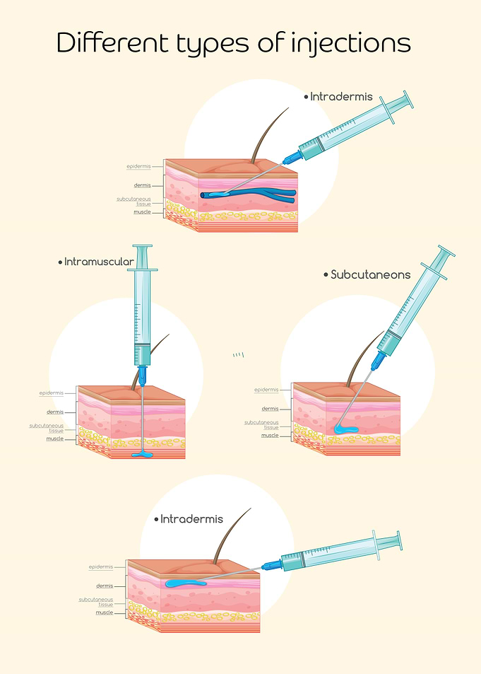 Different Types of Injections Illustration
