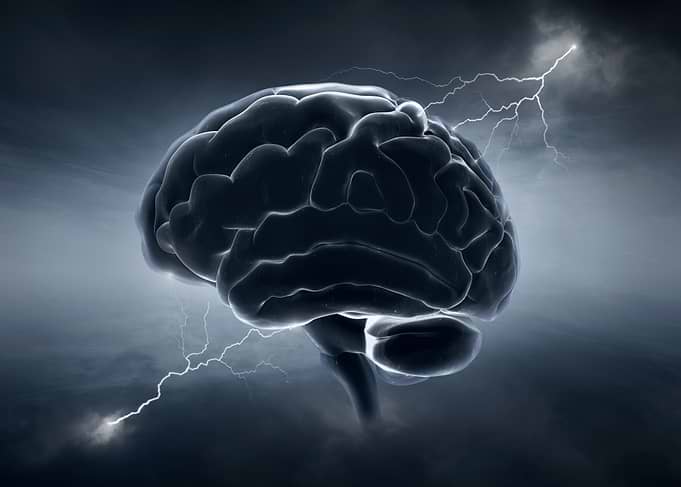 Brain with Lightning Strikes