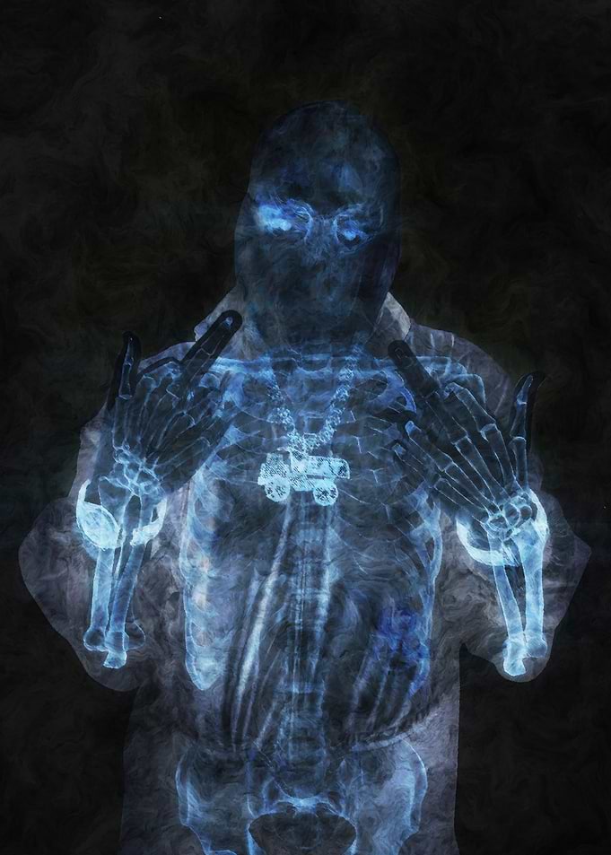 X-ray Skeleton with Jewelry
