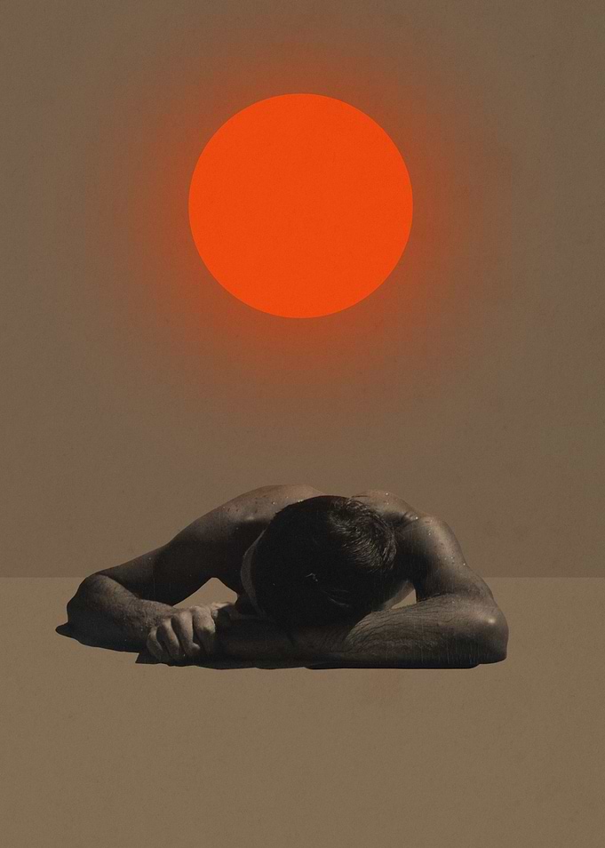 Sunburn