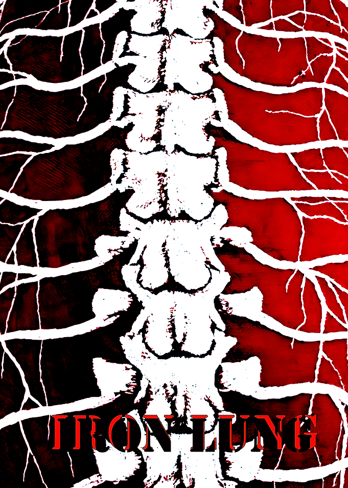 Iron Lung Spine and Veins