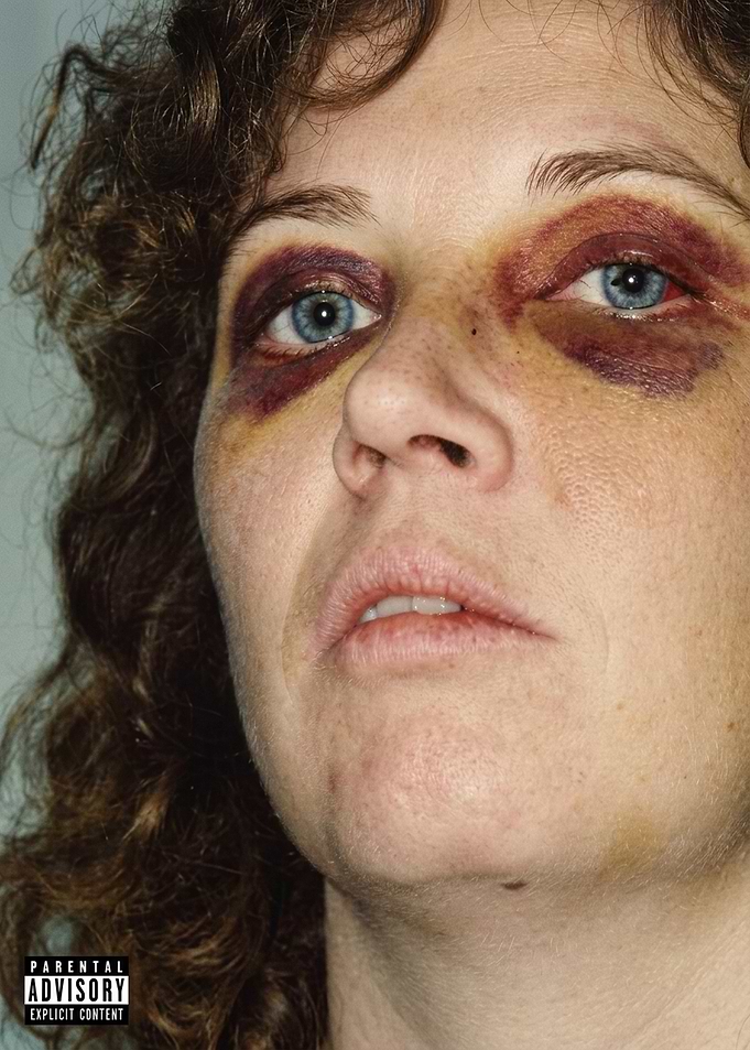 Close-up Portrait with Bruised Eyes
