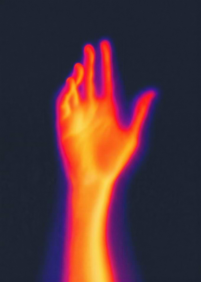 Thermal Imaging of a Human Hand