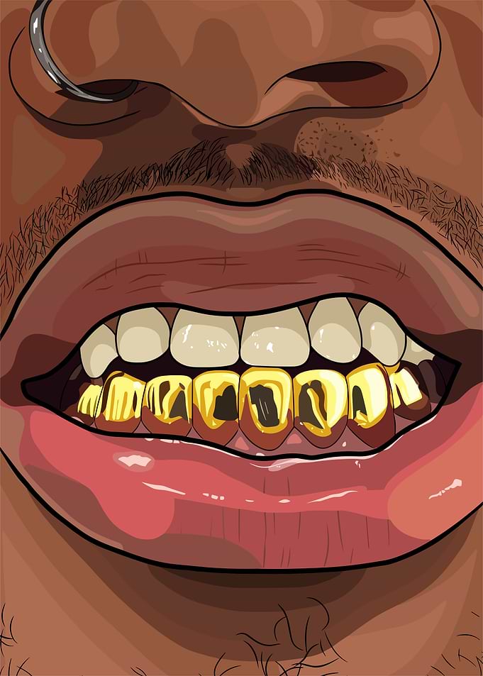 Close-up of Gold Grillz