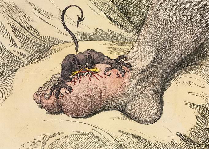 James Gillray The Gout Caricature