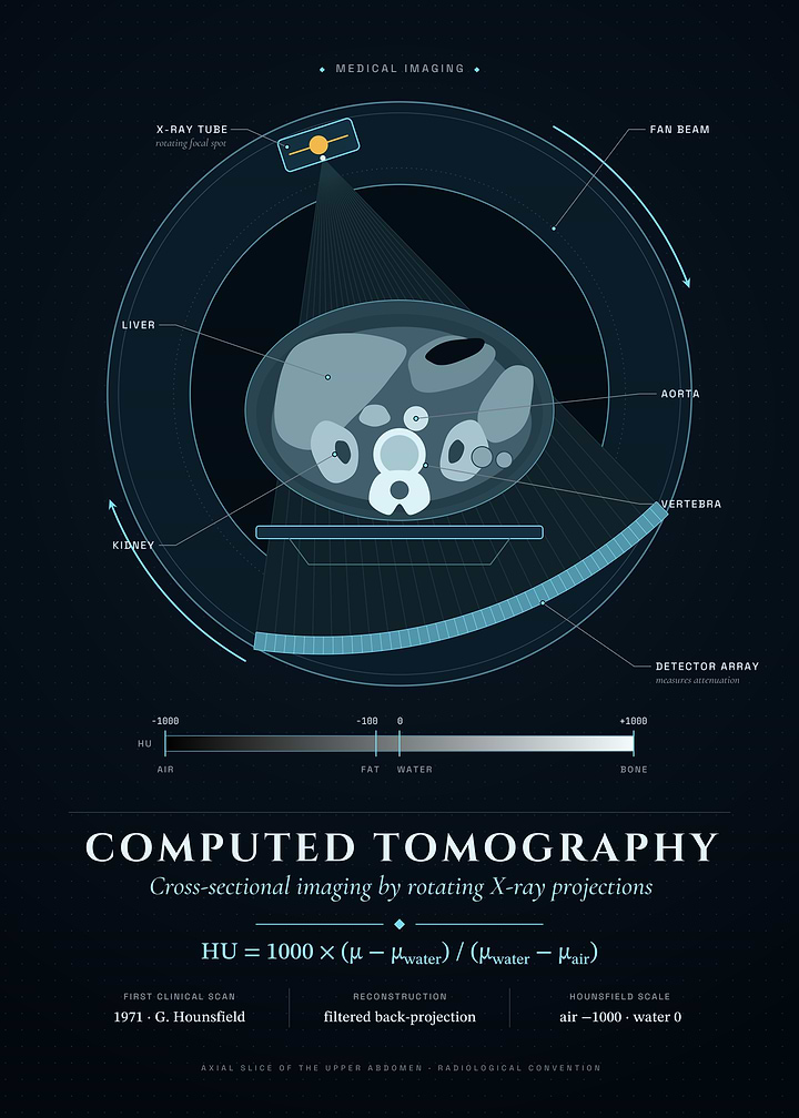 Computed Tomography: Inside the CT Gantry