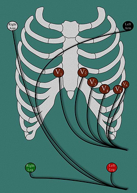 12-Lead EKG poster