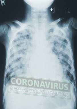 CORONAVIRUS