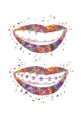 Teeth braces vs mouth