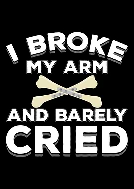 Broken Arm Shoulder Bone