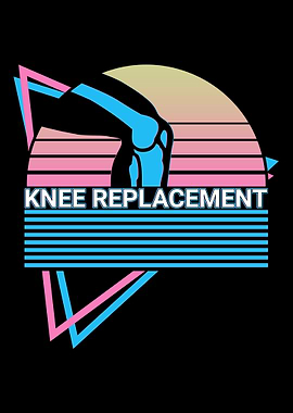 Knee Replacement Retro