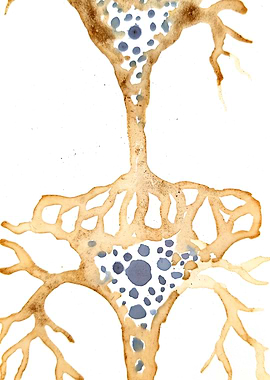 Pyramidal neuron connected Coffee Stain Neuron Art