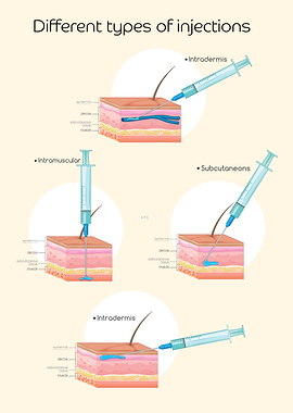 Different Types of Injections Illustration