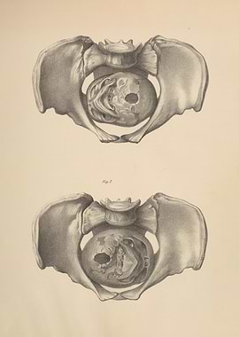 Anatomical Illustration of Pelvis and Fetus