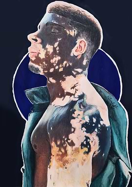 Portrait of a man with vitiligo