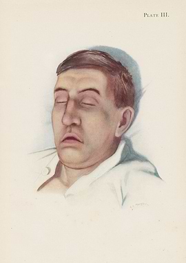 Illustration of a man in repose