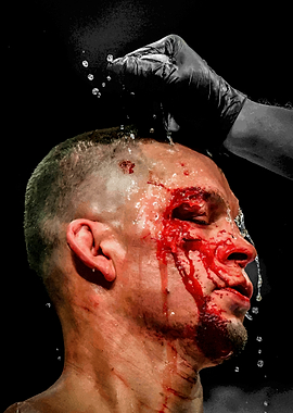 Nate Diaz
