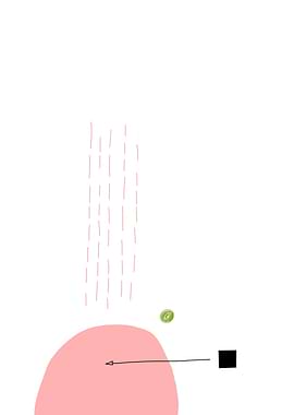 System & Irritation – Tension Composition