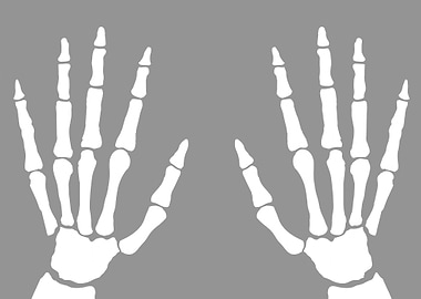 XRay Of Hands