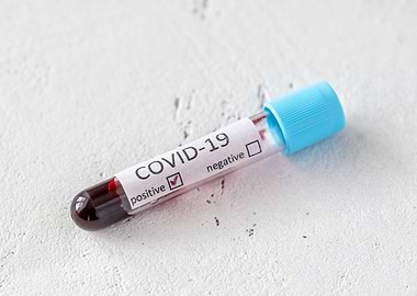 Coronavirus testing