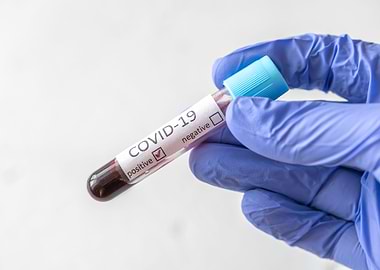 Coronavirus testing