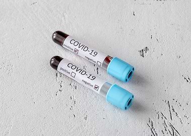 COVID19 test