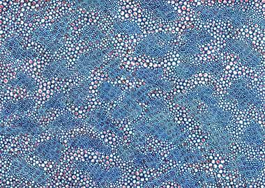 turquoise rings antidots