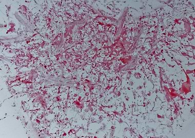 Fruit juice abstraction