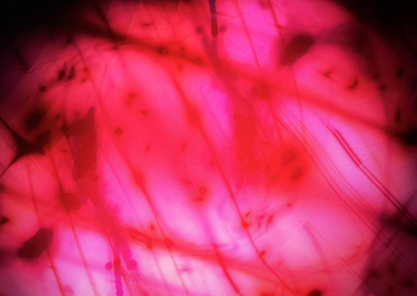 Ink blots pink blood veins