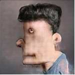 Ferdinand Trendelenburg