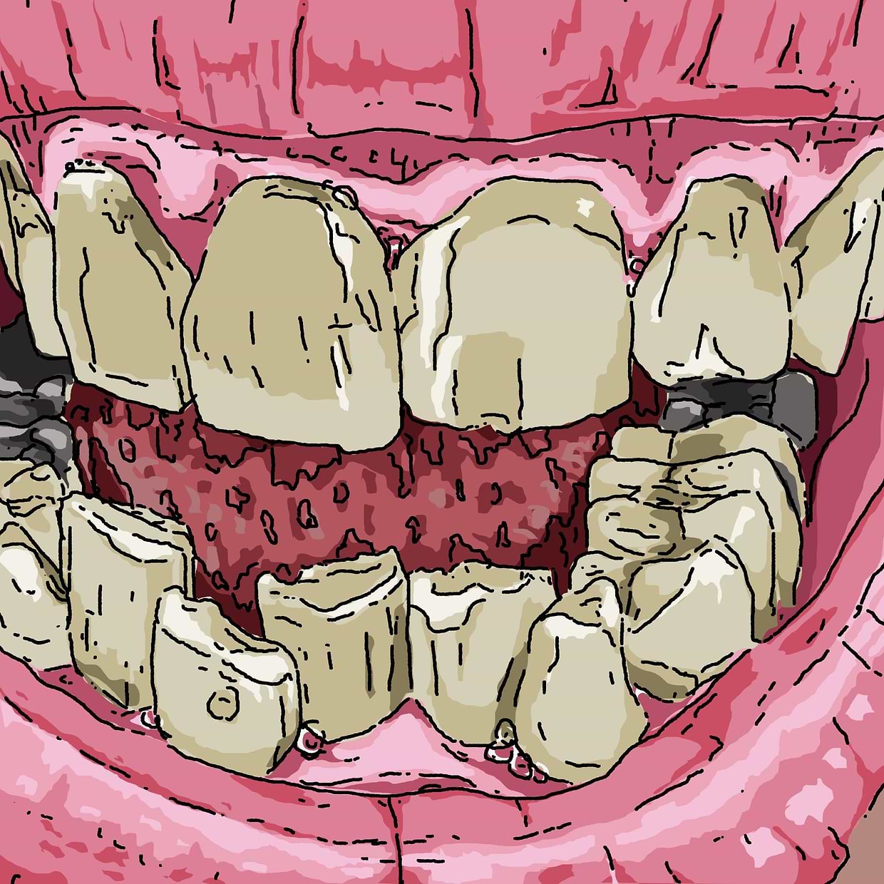 artist cover